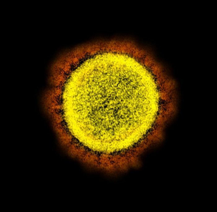 Koronavirus SARS-CoV-2 izolovaný z pacienta, elektr. mikroskop (foto: NIAID Integrated Research Facility, Fort Detrick, USA, public domain)